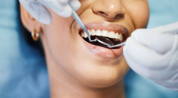Best Mobile Emergency Dentist in Woodbranch, TX