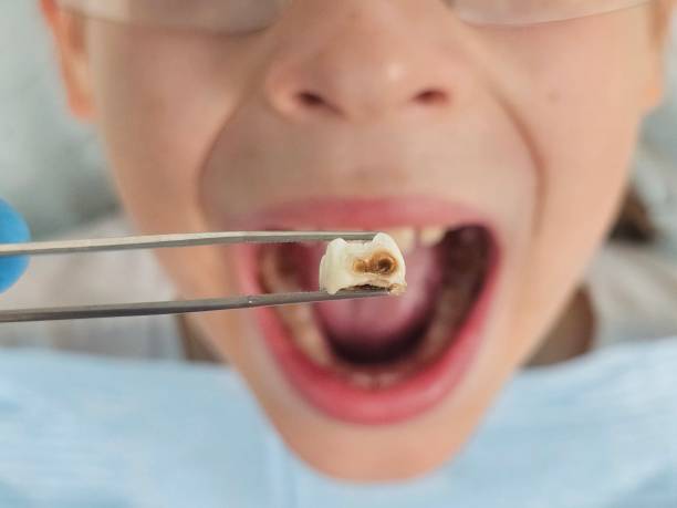 Best Emergency Cosmetic Dentistry in Woodbranch, TX